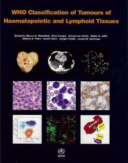 WHO classification of tumours of haematopoietic and lymphoid tissues