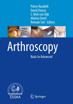 Arthroscopy Arthroscopy