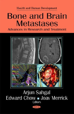 Bone & Brain Metastases