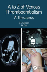 A to Z of Venous Thrombo-Embolism