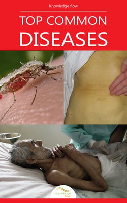 Top Common Diseases