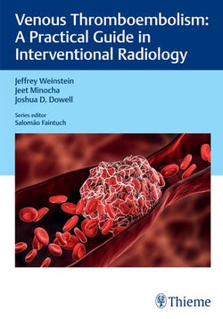Venous Thromboembolism