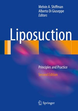 Liposuction Liposuction