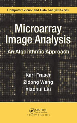 Microarray Image Analysis