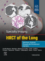 Specialty Imaging: HRCT of the Lung - E-Book