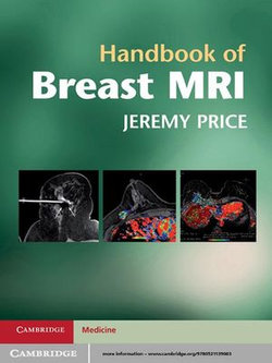 Handbook of Breast MRI Handbook of Breast MRI