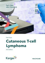 Fast Facts: Cutaneous T-cell Lymphoma