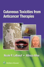 Cutaneous Reactions from Anticancer Therapies