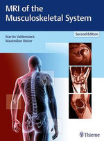 MRI of the Musculoskeletal System