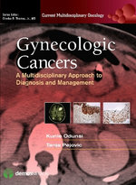 Gynecologic Cancers
