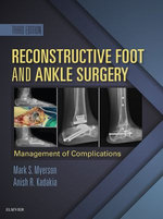 Reconstructive Foot and Ankle Surgery: Management of Complications E-Book