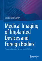 Medical Imaging of Implanted Devices and Foreign Bodies