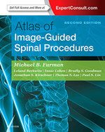 Atlas of Image-Guided Spinal Procedures