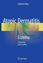 Atopic Dermatitis