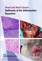 Head and Neck Cancer: Hallmarks of the Inflammation Ecosystem