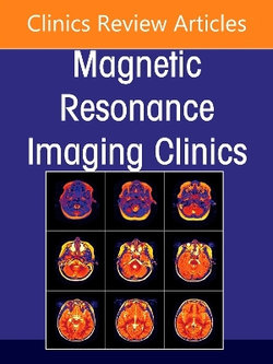 Spine Imaging, An Issue of Magnetic Resonance Imaging Clinics of North America: Volume 33-2