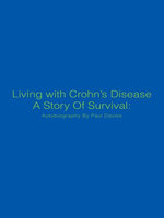 Living with Crohn’S Disease a Story of Survival: Autobiography by Paul Davies