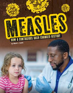 Measles