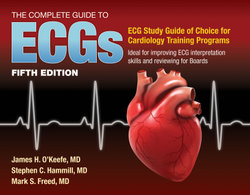 The Complete Guide to Ecgs a Comprehensive Study Guide to Improve ECG Interpretation Sk