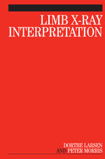 Limb X-Ray Interpretation