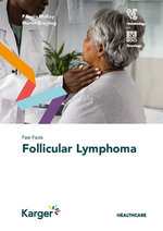 Fast Facts: Follicular Lymphoma