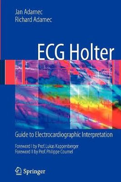 ECG Holter