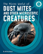 The Micro World of Dust Mites and Other Microscopic Creatures The Micro World of Dust Mites and Other Microscopic Creatures
