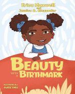 Beauty with a Birthmark