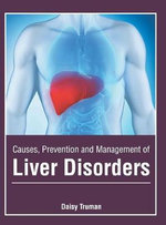 Causes, Prevention and Management of Liver Disorders Causes, Prevention and Management of Liver Disorders