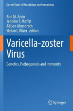 Varicella-zoster Virus