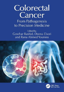 Colorectal Cancer Colorectal Cancer