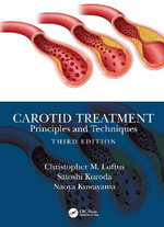 Carotid Treatment