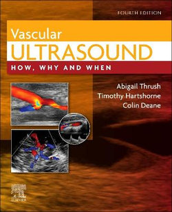 Vascular Ultrasound: How, Why and When, 4e