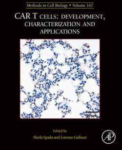 MCB: CAR T Cells: Development, Characterization and Applications MCB: CAR T Cells: Development, Characterization and Applications