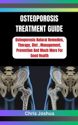 OSTEOPOROSIS TREATMENT GUIDE OSTEOPOROSIS TREATMENT GUIDE