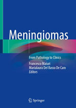 Meningiomas Meningiomas