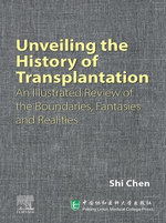 Unveiling the History of Transplantation