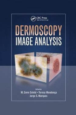 Dermoscopy Image Analysis Dermoscopy Image Analysis