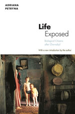 Life Exposed