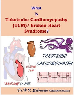 What is Takotsubo(stress) Cardiomyopathy (TCM)/ Broken Heart Syndrome?