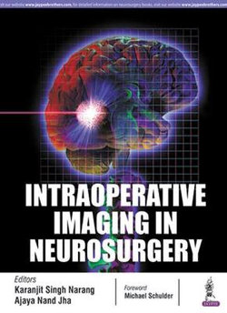 Intraoperative Imaging in Neurosurgery