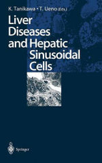 Liver Diseases and Hepatic Sinusoidal Cells