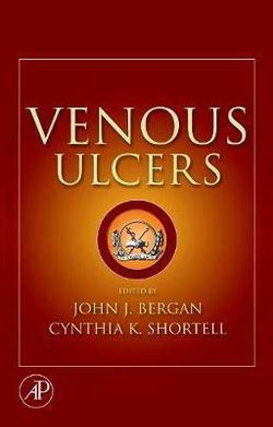 Venous Ulcers