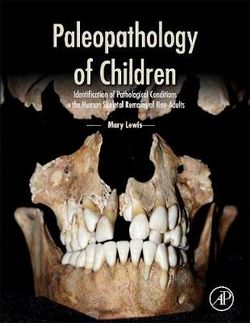Paleopathology of Children Paleopathology of Children