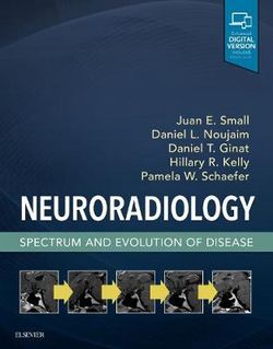 Neuroradiology: Spectrum and Evolution of Disease Neuroradiology: Spectrum and Evolution of Disease