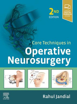 Core Techniques in Operative Neurosurgery E-Book Core Techniques in Operative Neurosurgery E-Book