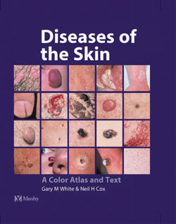 Diseases of the Skin
