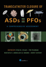Transcatheter Closure of ASDs and PFOs