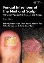 Fungal Infections of the Nail and Scalp