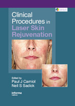 Clinical Procedures in Laser Skin Rejuvenation